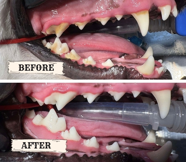 Teeth cleaning before after Teeth cleaning before after